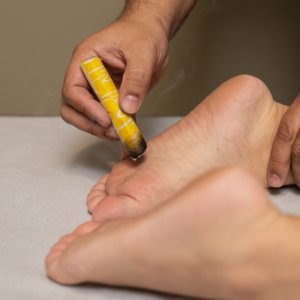 MOXIBUSTION PIED